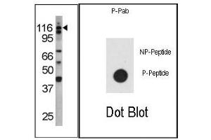 Image no. 1 for anti-Colony Stimulating Factor 2 Receptor, Beta (CSF2RB) (pTyr766) antibody (ABIN358147)