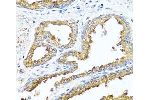 Immunohistochemistry of paraffin-embedded Human prostate using NCK2 Polyclonal Antibody at dilution of 1:100 (40x lens). (NCK2 anticorps)