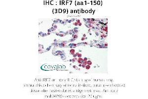Image no. 2 for anti-Interferon Regulatory Factor 7 (IRF7) (AA 1-150) antibody (ABIN1723206) (IRF7 anticorps  (AA 1-150))
