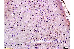 Formalin-fixed and paraffin embedded rat brain labeled with Anti JMY Polyclonal Antibody, Unconjugated (ABIN872348) at 1:200 followed by conjugation to the secondary antibody and DAB staining