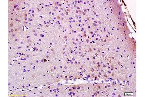 Formalin-fixed and paraffin embedded rat brain labeled with Anti JMY Polyclonal Antibody, Unconjugated (ABIN872348) at 1:200 followed by conjugation to the secondary antibody and DAB staining (JMY anticorps  (AA 401-500))