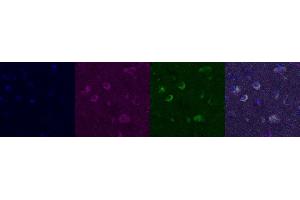 Immunohistochemistry (IHC) image for anti-Kv Channel Interacting Protein 2 (KCNIP2) antibody (ABIN7456001)