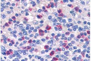 Human Spleen: Formalin-Fixed, Paraffin-Embedded (FFPE) (PGLYRP1 anticorps  (AA 179-189))