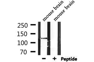 Western blot analysis of extracts from mouse brain, using CTNND2 Antibody.
