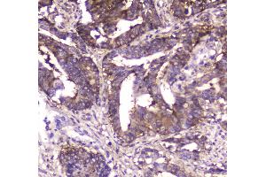 IHC analysis of MVP using anti-MVP antibody .