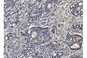 IHC analysis of SAP18 using anti-SAP18 antibody (ABIN7599009). (SAP18 anticorps  (AA 1-153))