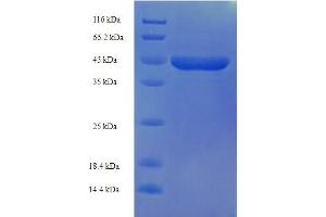 SDS-PAGE (SDS) image for Ethylmalonic Encephalopathy 1 (ETHE1) (AA 8-254) protein (His-SUMO Tag) (ABIN5709487)