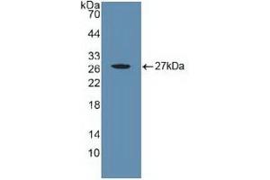 Detection of Recombinant CYR61, Human using Polyclonal Antibody to Cysteine Rich Protein, Angiogenic Inducer 61 (CYR61) (CYR61 anticorps  (AA 178-381))
