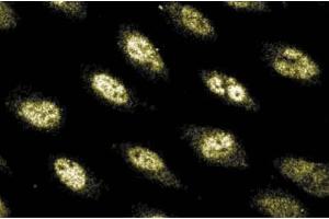 Immunofluorescence staining of Human Endothelial cells. (POLD1 anticorps  (AA 60-261))