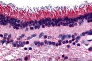 Human Retina (formalin-fixed, paraffin-embedded) stained with PTPRM antibody ABIN297531 at 16 ug/ml followed by biotinylated goat anti-rabbit IgG secondary antibody ABIN481713, alkaline phosphatase-streptavidin and chromogen. (PTPRM anticorps  (Internal Region))