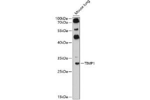 Immunofluorescence analysis of HeLa cells using TIMP1 antibody (ABIN6128284, ABIN6149176, ABIN6149177 and ABIN6218052) at dilution of 1:100. (TIMP1 anticorps  (AA 24-207))