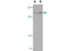 Western blot analysis of PIGY in human spleen tissue lysate with PIGY polyclonal antibody  at (A) 1 and (B) 2 ug/mL . (PIGY anticorps  (Internal Region))