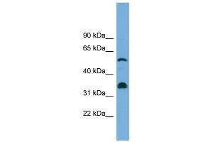 CYP26B1 antibody used at 1 ug/ml to detect target protein. (CYP26B1 anticorps  (Middle Region))