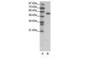 Image no. 1 for anti-Forkhead Box C2 (MFH-1, Mesenchyme Forkhead 1) (FOXC2) (AA 412-461) antibody (ABIN202668) (FOXC2 anticorps  (AA 412-461))