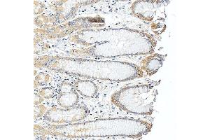 IHC analysis of SLC25A23 using anti-SLC25A23 antibody (ABIN7600165).