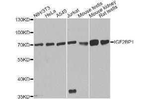 Western blot analysis of extracts of various cell lines, using IGF2BP1 antibody. (IGF2BP1 anticorps  (C-Term))