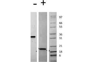 SDS-PAGE of Mouse Platelet Derived Growth Factor AA Recombinant Protein SDS-PAGE of Mouse Platelet Derived Growth Factor-AA Recombinant Protein. (PDGF-AA Homodimer Protéine)