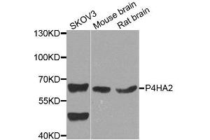 Western blot analysis of extracts of various cell lines, using P4HA2 antibody.