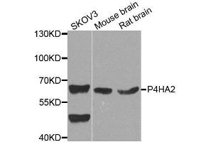 Western blot analysis of extracts of various cell lines, using P4HA2 antibody. (P4HA2 anticorps  (AA 234-533))