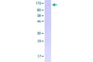 Image no. 1 for Myb-Like, SWIRM and MPN Domains 1 (MYSM1) (AA 1-828) protein (GST tag) (ABIN1311866)