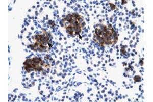 Image no. 1 for anti-Zinc Finger Protein 182 (ZNF182) (AA 543-592) antibody (ABIN6735968)