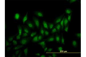 Immunofluorescence of monoclonal antibody to LRRFIP1 on HeLa cell. (LRRFIP1 anticorps  (AA 675-784))