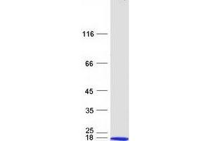 Validation with Western Blot