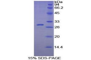 SDS-PAGE (SDS) image for C-Reactive Protein (CRP) (AA 20-225) protein (His tag,SUMO Tag) (ABIN1098912)