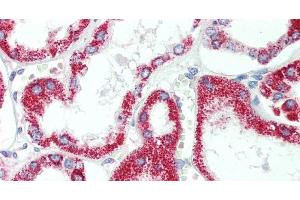 Immunohistochemistry of paraffin-embedded Human Kidney using HSD17B8 Polyclonal Antibody at dilution of 1:100. (HSD17B8 anticorps)