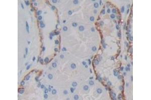 IHC-P analysis of Human Tissue, with DAB staining. (IL18RAP anticorps  (AA 310-451))