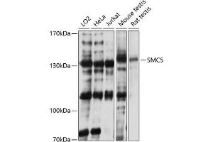 Western blot analysis of extracts of various cell lines, using SMC5 antibody (ABIN1682829, ABIN3015966, ABIN3015967 and ABIN6219480) at 1:3000 dilution. (SMC5 anticorps  (AA 872-1101))