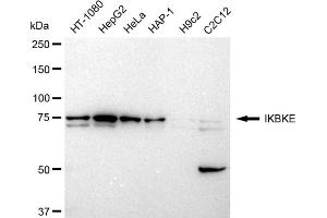Western blotting analysis using IKBKE antibody (ABIN7799035).