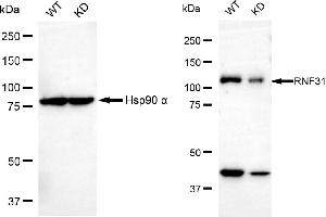 Western blotting analysis using RNF31 antibody (ABIN7800250). (RNF31 anticorps)