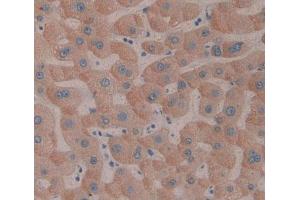IHC-P analysis of Human Tissue, with DAB staining. (SMOX anticorps  (AA 1-165))