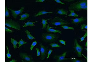 Immunofluorescence of monoclonal antibody to USP9X on HeLa cell. (USP9X anticorps  (AA 1-90))