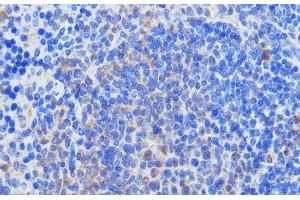 Immunohistochemistry of paraffin-embedded Mouse spleen using RBM39 Polyclonal Antibody at dilution of 1:100 (40x lens).