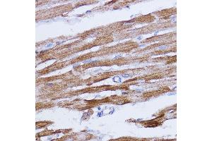 Immunohistochemistry of paraffin-embedded rat heart using NDUFB7 antibody (ABIN6132403, ABIN6144480, ABIN6144481 and ABIN6217781) at dilution of 1:100 (40x lens). (NDUFB7 anticorps  (AA 1-137))