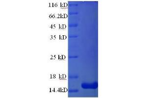 Resistin (RETN) (AA 19-109) protein (His tag) expressed in E.