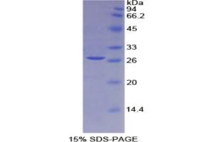 SDS-PAGE analysis of Rat IL2Ra Protein. (CD25 Protéine)
