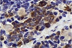 Immunohistochemistry analysis of paraffin-embedded mouse spleen using,NK-p44 (ABIN7074778) at dilution of 1: 500 (NKp44/NCR2 anticorps)
