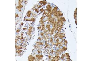 Immunohistochemistry of paraffin-embedded mouse pancreas using PNLIPRP1 antibody (ABIN7269167) at dilution of 1:100 (40x lens).