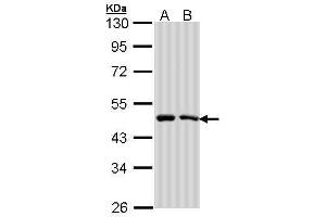 WB Image Sample (30 ug of whole cell lysate) A: A431 , B: H1299 10% SDS PAGE antibody diluted at 1:1000 (SIL1 anticorps  (C-Term))