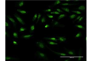 Immunofluorescence of monoclonal antibody to GIT2 on HeLa cell.