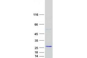 Validation with Western Blot