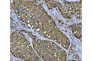 IHC analysis of TMC7 using anti-TMC7 antibody (ABIN7602499).