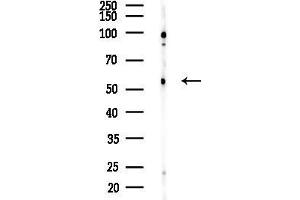 Western blot analysis of lysates from Rat brain, using ACVR1C Antibody at 1/1000 dilution.