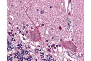 Anti-AP1G1 / Gamma Adaptin antibody IHC of human brain, cerebellum.