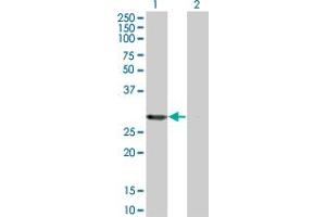 Western Blot analysis of PSME2 expression in transfected 293T cell line by PSME2 monoclonal antibody (M01), clone 3F11-1A3.