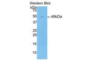 Western blot analysis of the recombinant protein. (NR1I2 anticorps  (AA 205-390))