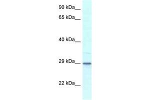 WB Suggested Anti-Kcnip3 Antibody   Titration: 1. (DREAM anticorps  (Middle Region))